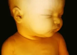 baby