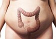 3d rendered illustration of an overweight man – colon