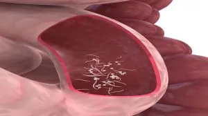parasite 