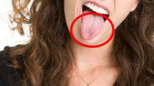 Does Your Tongue Have These? Here’s Why