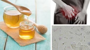 Would You Put Honey In Your Vagina For A Yeast Infection?