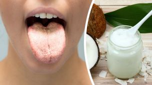I Used These 4 Tricks To Cure Candida In A Week