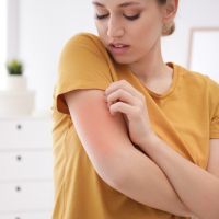 Woman scratching arm indoors, space for text. Allergy symptoms